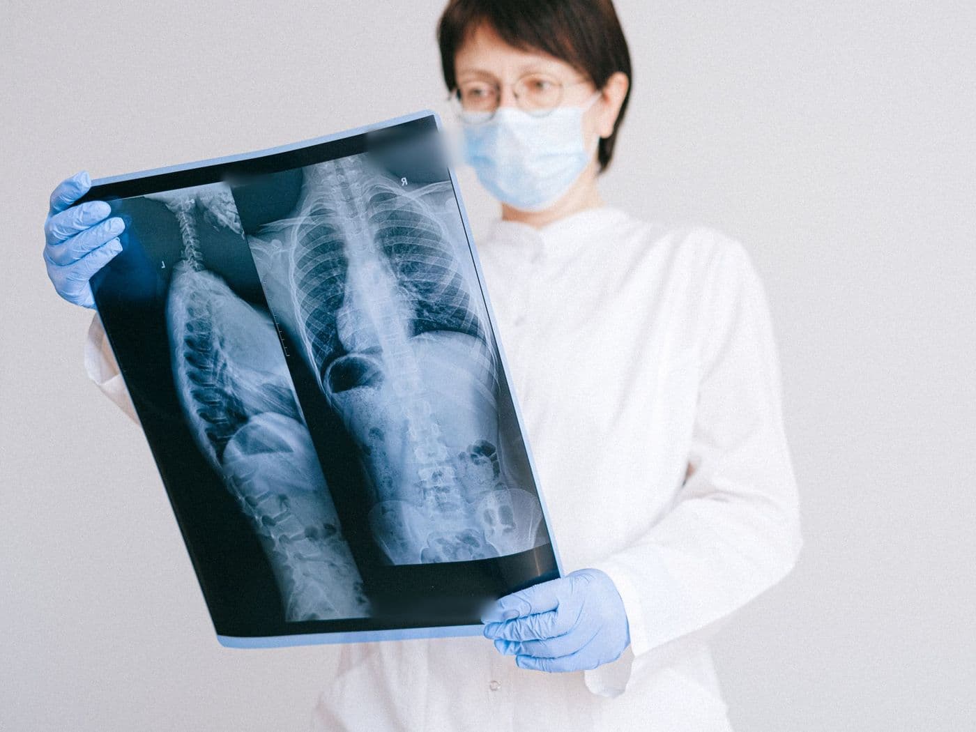 Doctor reviewing an X-ray film