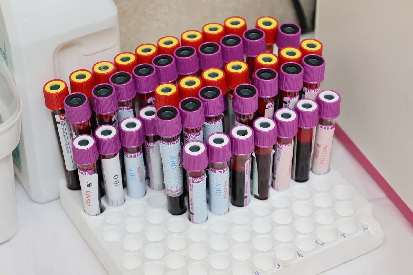 Understanding Pathology Services